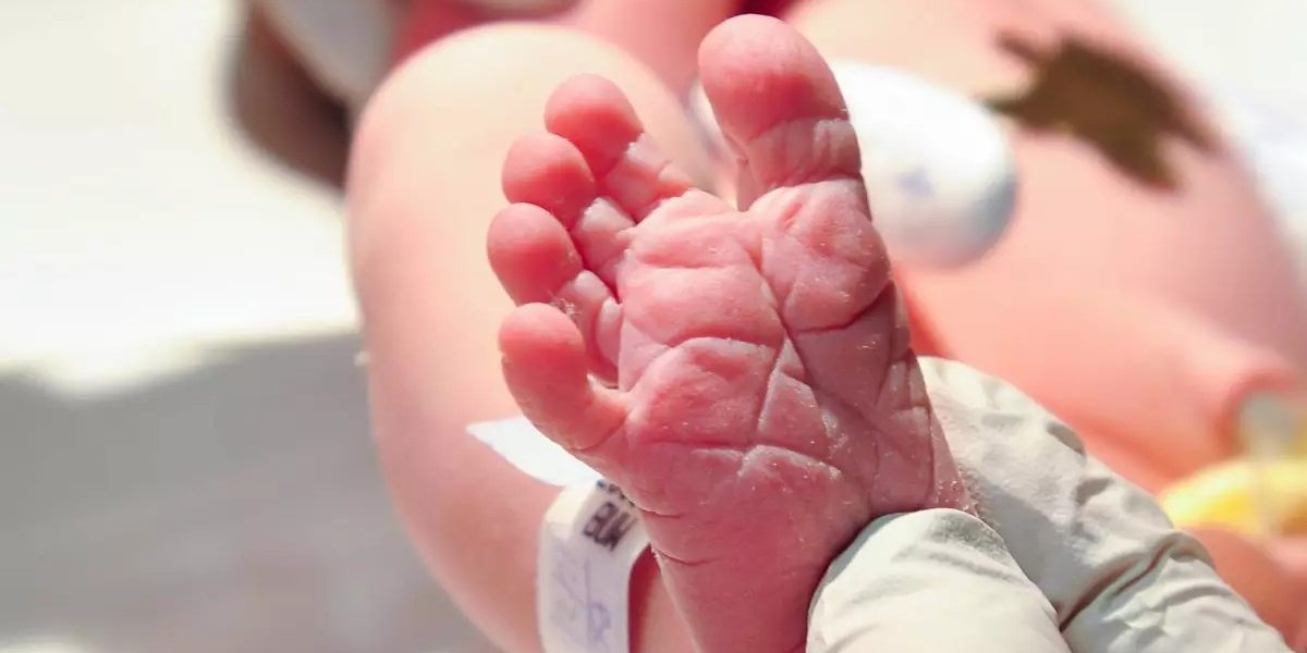 Dia Nacional do Teste do Pezinho reforça a importância da triagem neonatal