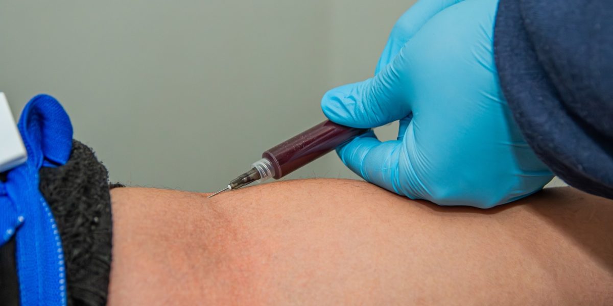 Prefeitura vai criar Ação Emergencial de Redução de Filas