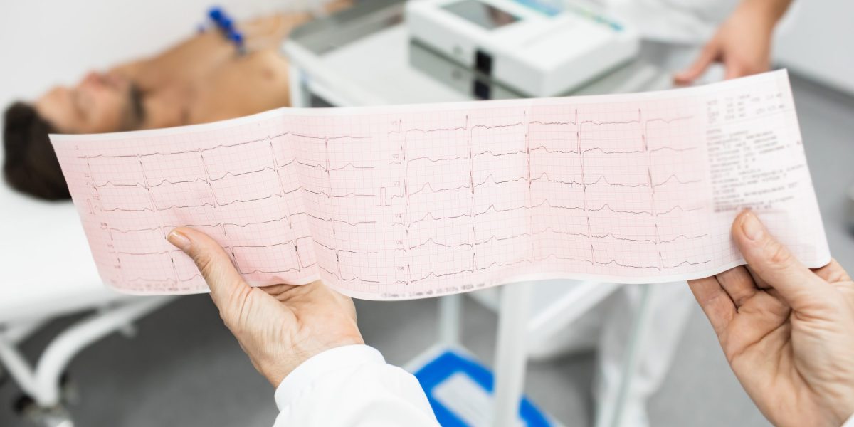 Casos de infarto aumentam entre homens jovens no Brasil