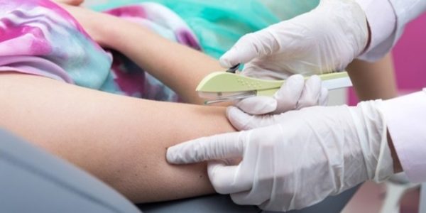 Canguçu realizou 95 inserções do anticoncepcional Implanon pelo SUS